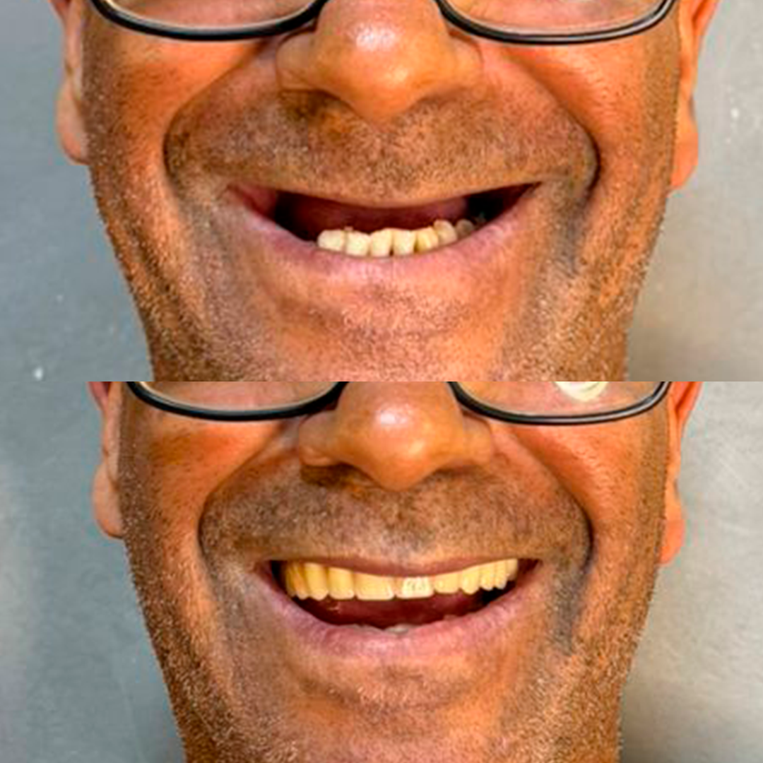 Caso-004.png